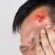 workers comp head injury settlements